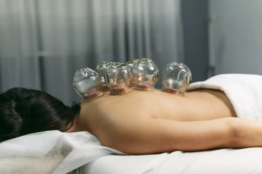 Acupressure & Cupping Therapy